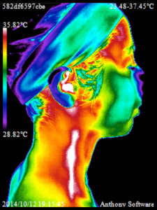 thermal image of woman - cove wellness la jolla ca