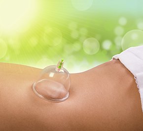 Cupping - Medicupping Vacuum Therapy for facelift and body contouring at Cove Wellness La Jolla, CA